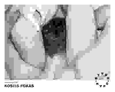 Untitled 023 - Hyper Hypo poster 068