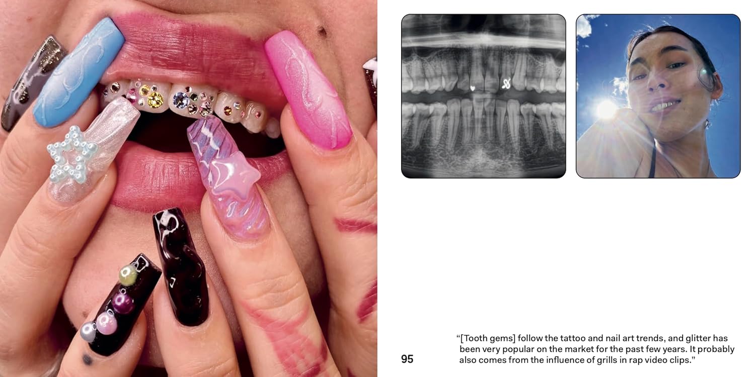 Tooth Gem Style: Bedazzled Smiles From Around The World
